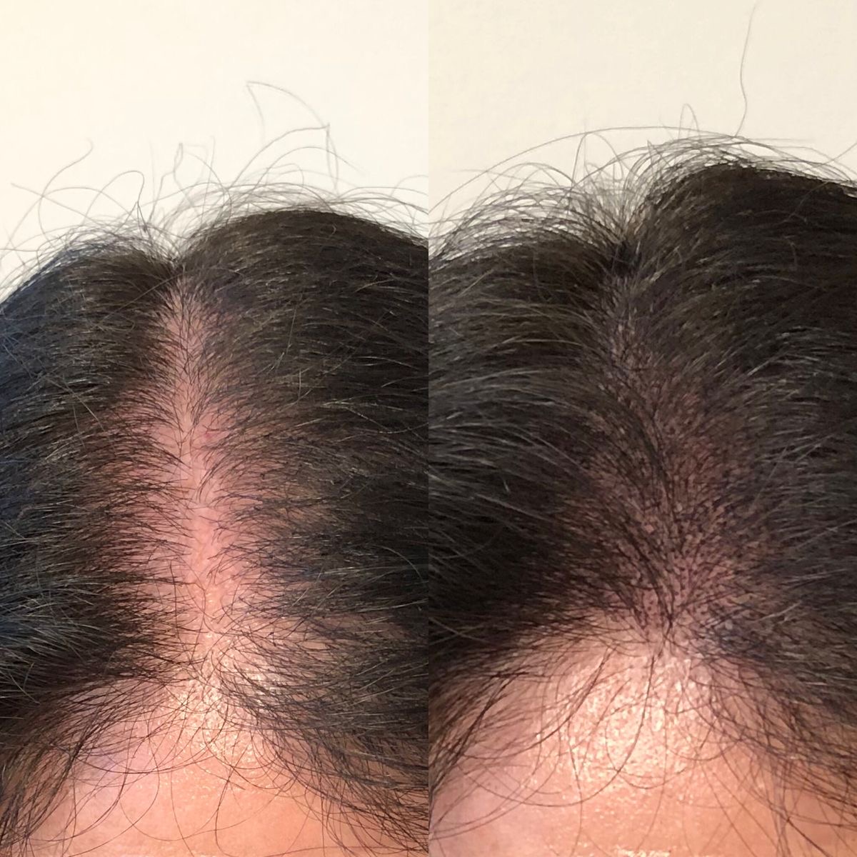 SMP — before & after